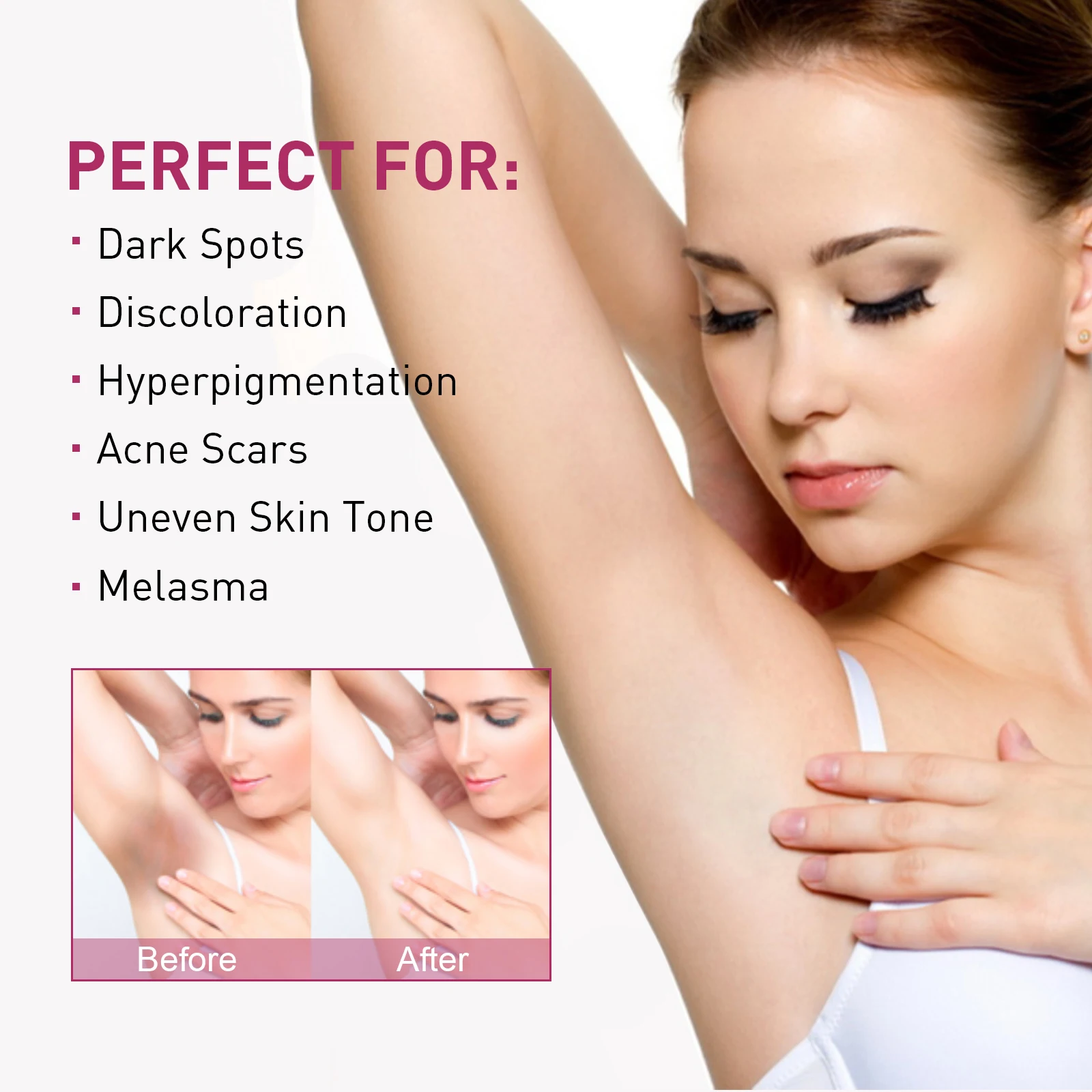 Whitening Cream for Dark Skin – Underarm, Thigh & Sensitive Area Lightening Lotion - Image 2