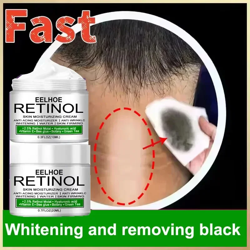 Whitening Cream for Dark Skin – Underarm, Thigh & Sensitive Area Lightening Lotion