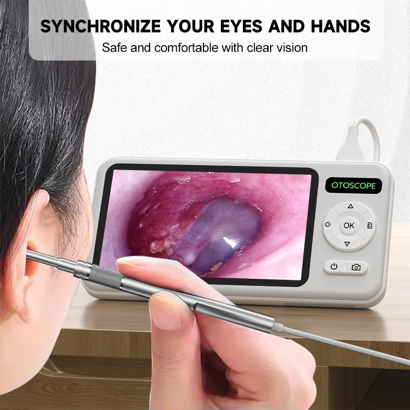 4.5" HD Otoscope Ear Wax Removal Tool, 1080P Camera, 6 LED Lights - Image 2