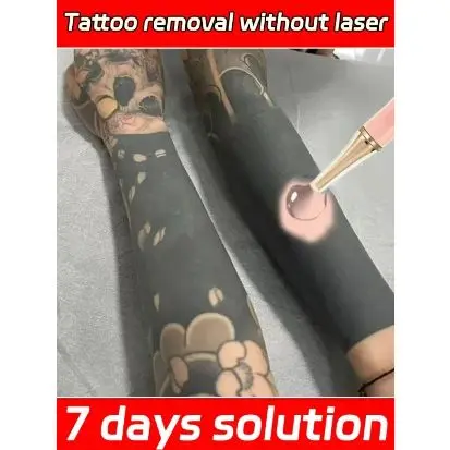 Tattoo Removal Gel – Painless Skin Repair & Deep Cleansing Moisturizing Care
