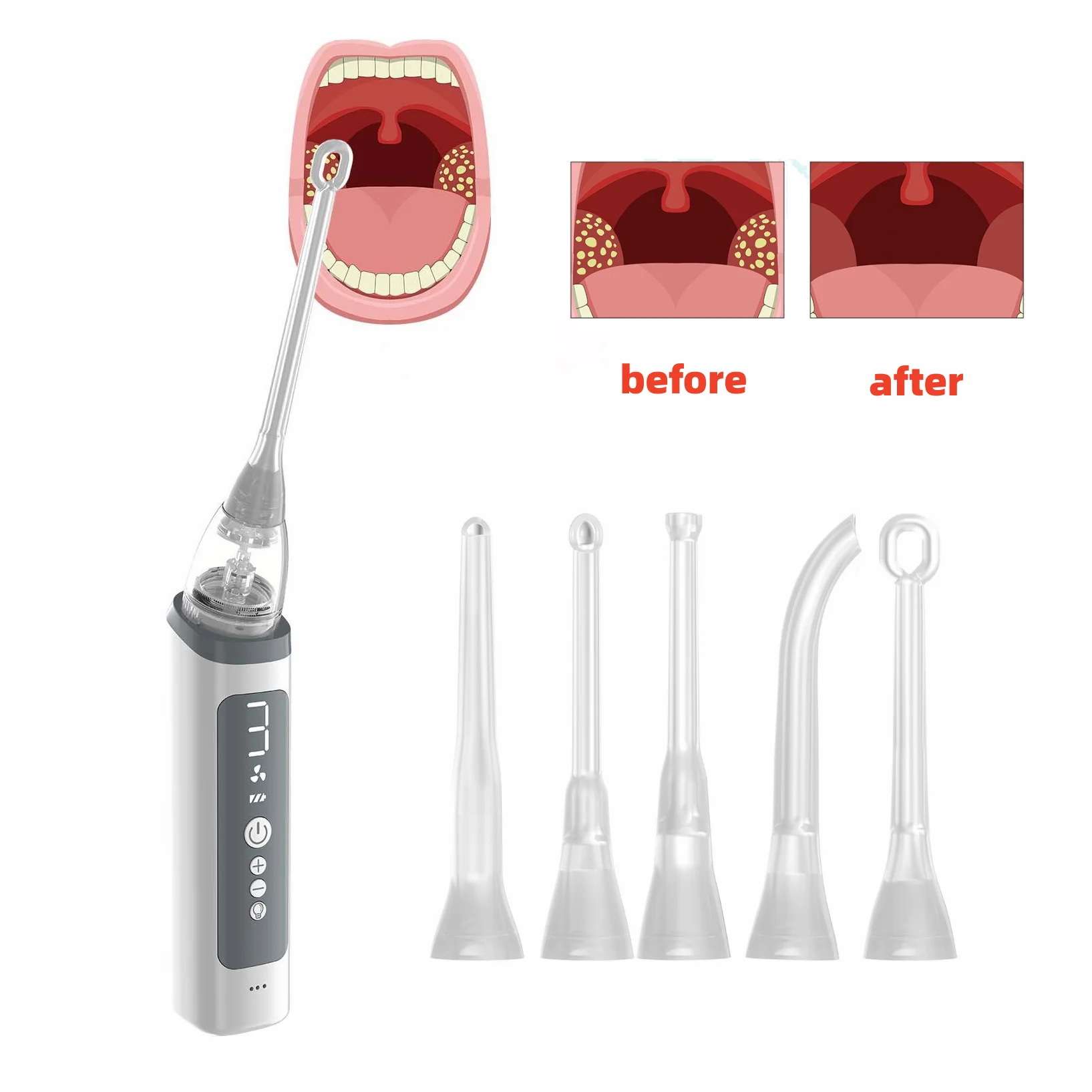 Electronic Tonsil Stone Remover Kit – 5 Suction Modes, LED Light
