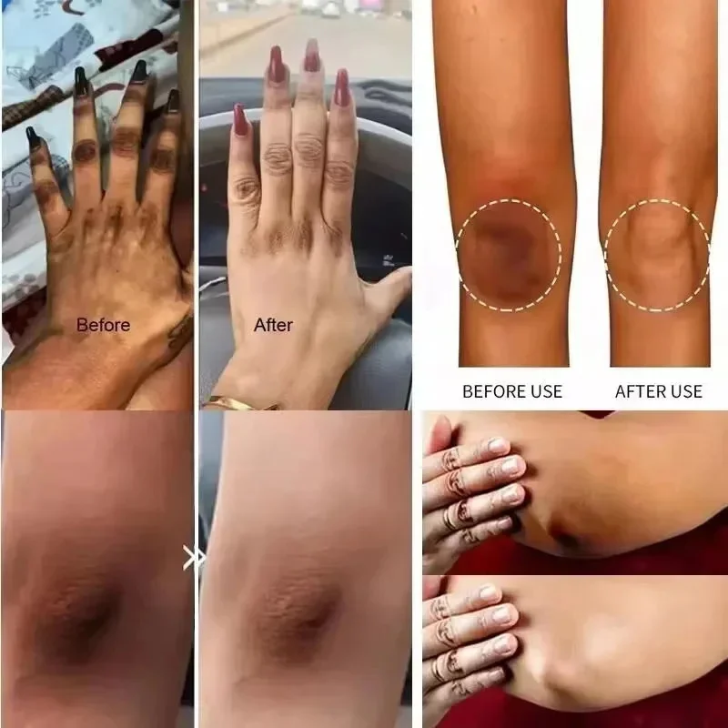 Whitening Cream for Dark Skin – Underarm, Thigh & Sensitive Area Lightening Lotion - Image 2