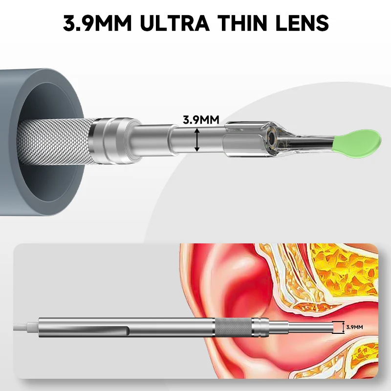 4.5" HD Otoscope Ear Wax Removal Tool, 1080P Camera, 6 LED Lights - Image 4