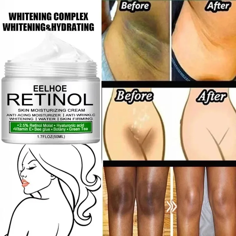 Whitening Cream for Dark Skin – Underarm, Thigh & Sensitive Area Lightening Lotion - Image 3