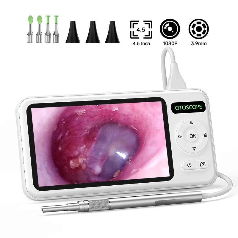 4.5" HD Otoscope Ear Wax Removal Tool, 1080P Camera, 6 LED Lights